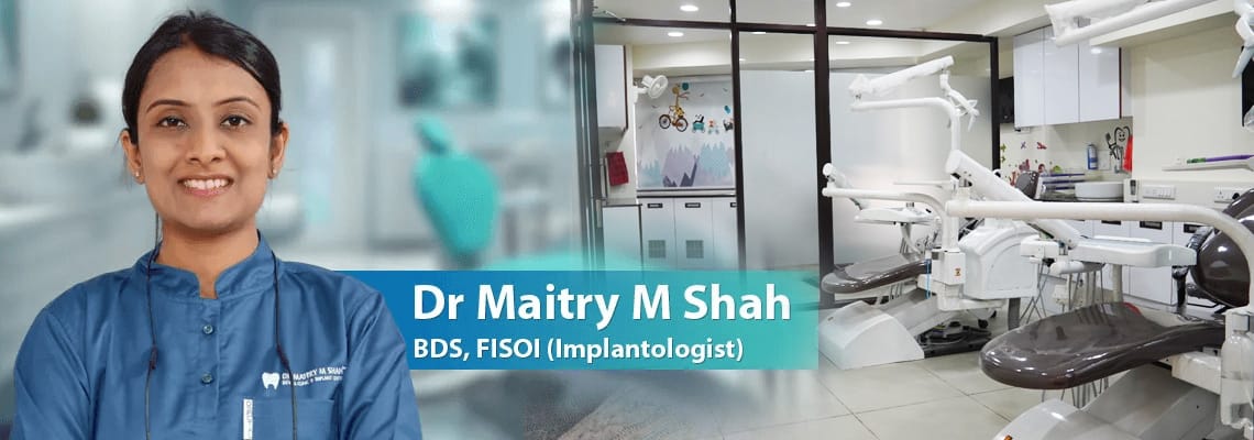 Top Dental Implant Clinic in Ahmedabad