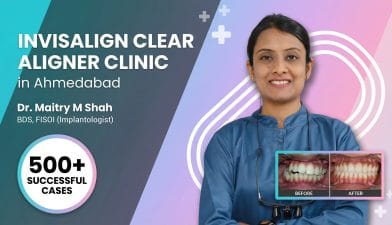 Invisalign Clear Aligner Clinic in Ahmedabad