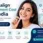 Invisalign Treatment Cost in India 85x85