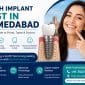 Tooth Implant Cost in Ahmedabad 85x85
