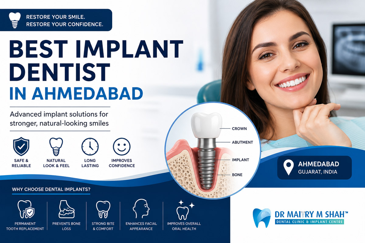 Best Implant Dentist in Ahmedabad | Dental Implants Expert